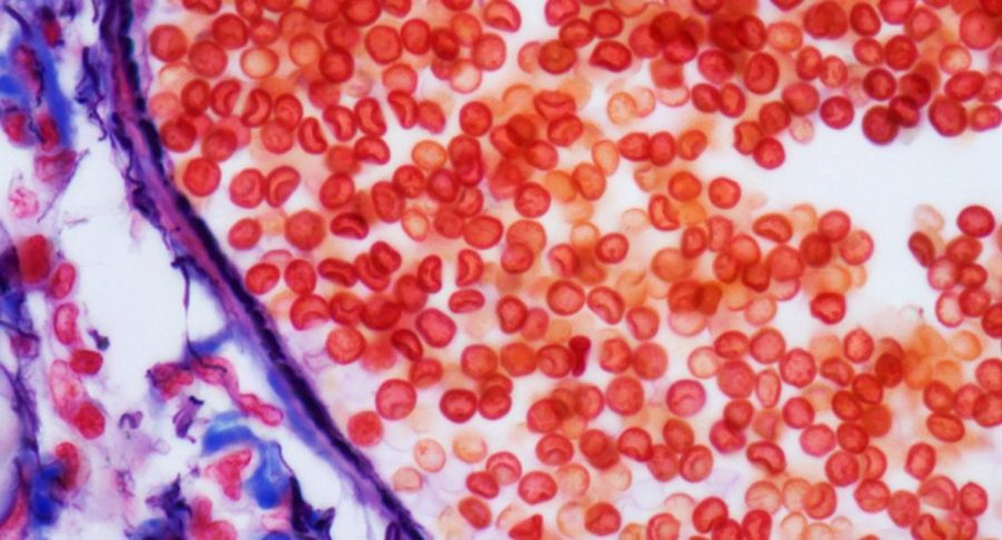 Кровь под микроскопом